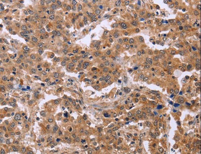 IHC-plus™ Polyclonal Rabbit anti-Human EPDR / EPDR1 Antibody (IHC, WB)
