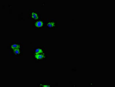 APP / Beta Amyloid Precursor Antibody (clone 5A11E5)