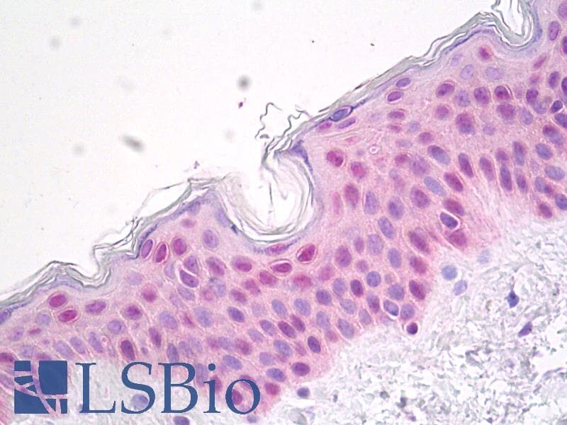 IHC-plus™ Polyclonal Rabbit Heat Shock Protein 70 / HSPA1A Antibody (IHC, WB)