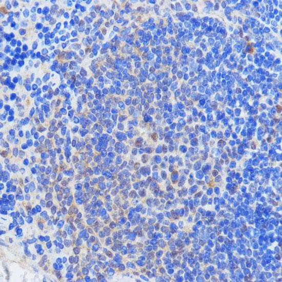 RBM39 Antibody