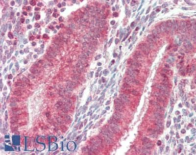 IHC-plus™ RENT1 / UPF1 Antibody (aa1079-1129)