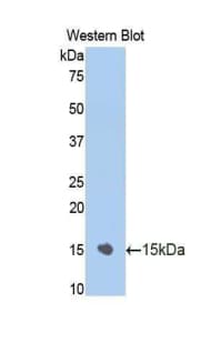 NR3C1/Glucocorticoid Receptor Antibody (aa106-211, Biotin)