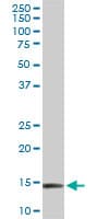 RPL36A / Ribosomal Protein L36 Antibody (clone 5F8)
