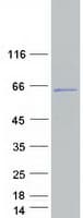 Human CCDC83 Protein (Recombinant Myc-DDK (Flag))