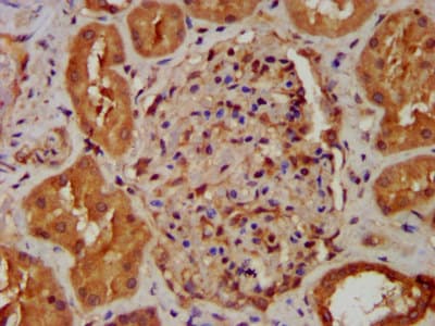 NDUFB8 Antibody