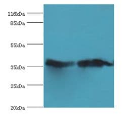 CA-VB / CA5B Antibody (HRP)