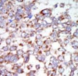 MAP3K7 / TAK1 Antibody (aa574-606)
