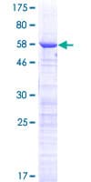 Human CCDC59 Protein (Recombinant GST)