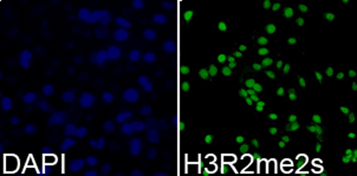 Histone H3 Antibody (Sym-Dimethyl-Arg2)