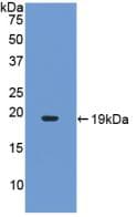Human IL17A Protein (Recombinant His, N-Terminal)