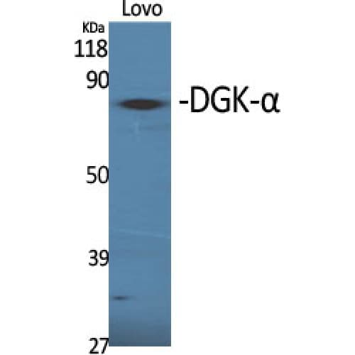 Polyclonal Rabbit anti-Human DGKA Antibody (280-360 aa, Internal, IHC, WB)