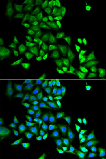 IHC-plus™ GDI1 Antibody