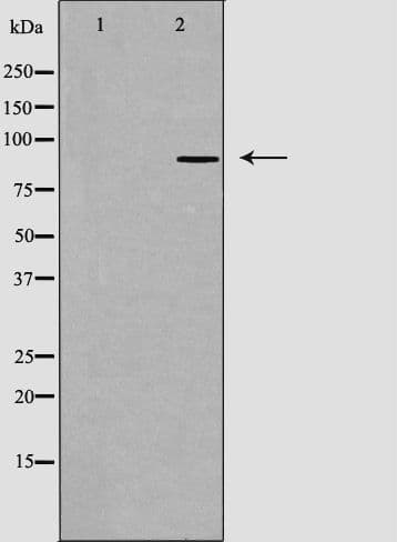 CDH8 / Cadherin 8 Antibody