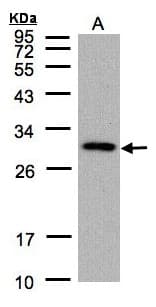 CTDSP2 Antibody (aa26-271)