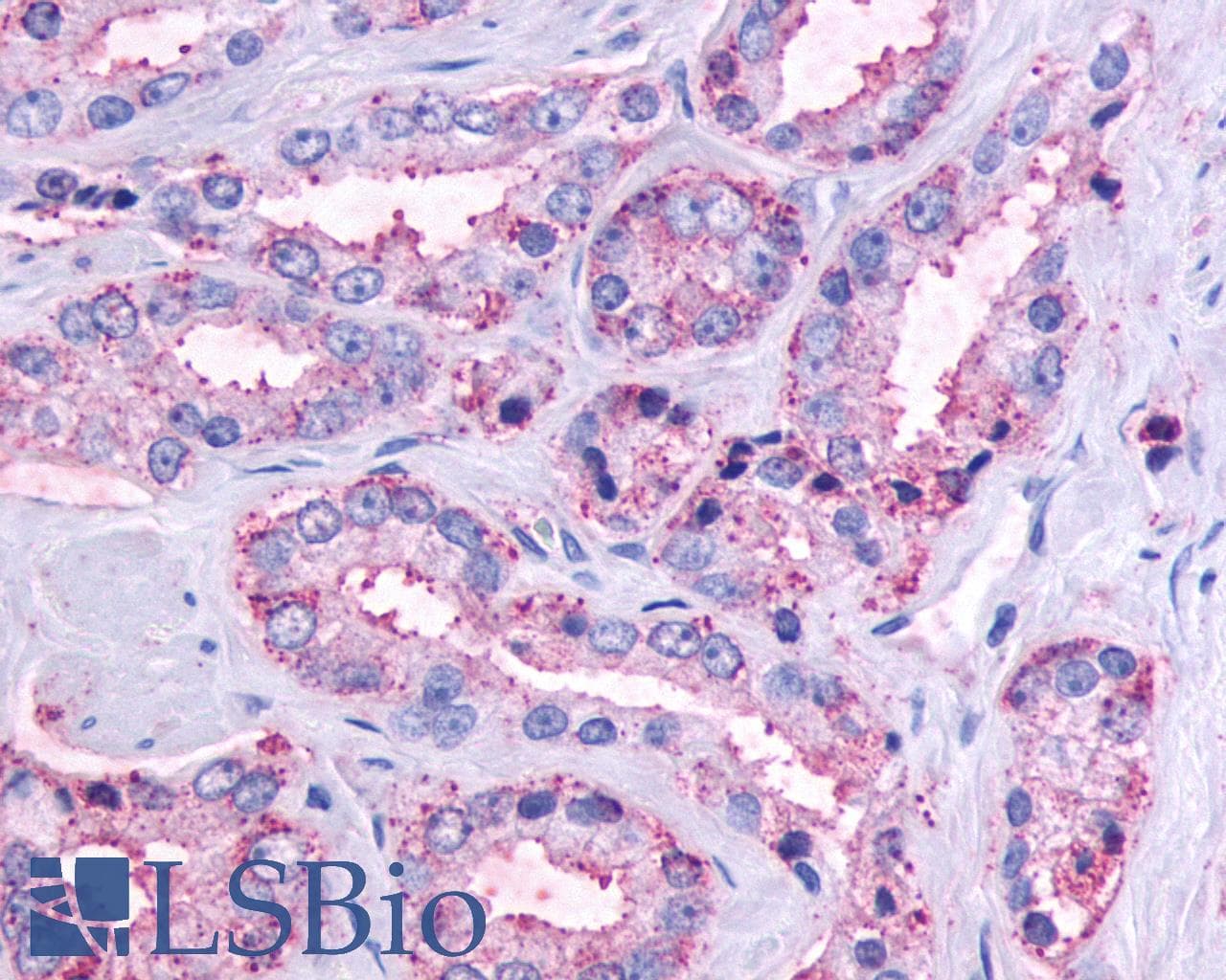 PathPlus™ OR51E1 Antibody (C-Terminus)