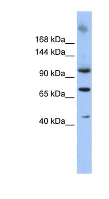 TUT1 Antibody (aa253-302)