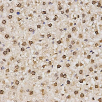 Histone H3 Antibody (Di-Methyl-Lys14)