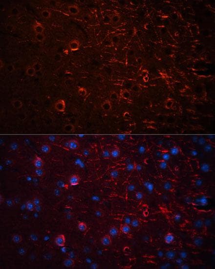 AQP4 / Aquaporin 4 Antibody