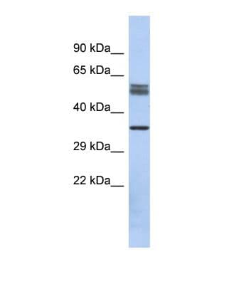 DBT / E2 Antibody (aa83-132)