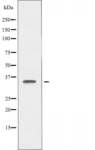 AASDHPPT / LYS5 Antibody
