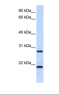 EMA / MUC1 Antibody (aa38-87)
