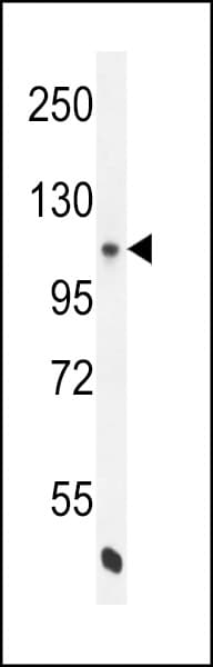 NOS3 / eNOS Antibody (Ser1177)