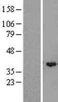 ZMYND12 Protein (Over-Expression Lysate Myc-DDK (Flag))