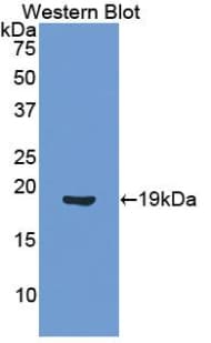 ANGPT1 / Angiopoietin-1 Antibody (aa284-452)