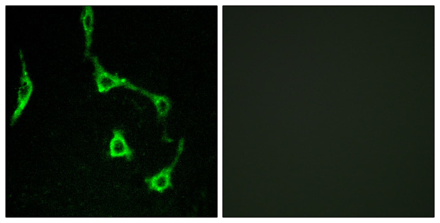 CDH10 / Cadherin 10 Antibody (aa201-250)