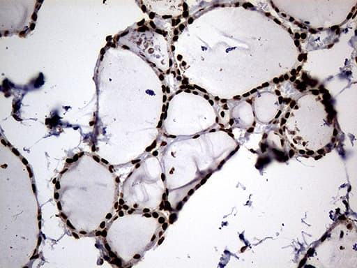 Monoclonal Mouse anti-Human HNRNPH1 / hnRNP H Antibody (clone OTI1H3, Carrier-free, IHC, WB)