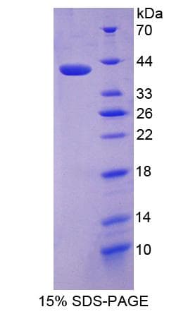 Human P4HA3 Protein (Recombinant His-S)