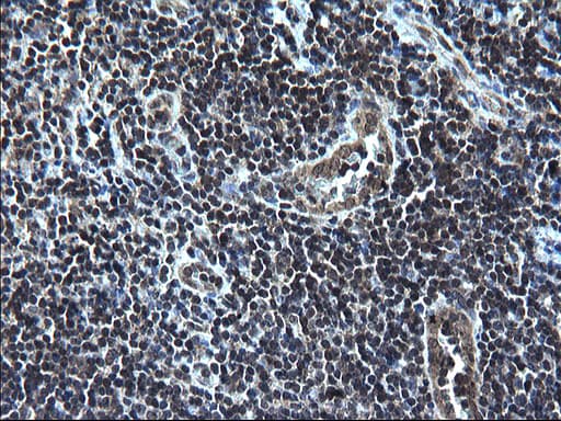 ZFAND3 / TEX27 Antibody (clone OTI1C5)