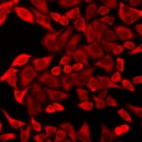 PFK2 / PFKFB3 Antibody