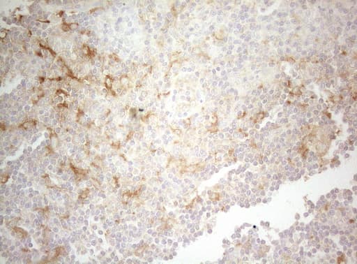TWF1 / PTK9 Antibody (aa140-384, clone OTI5C12)
