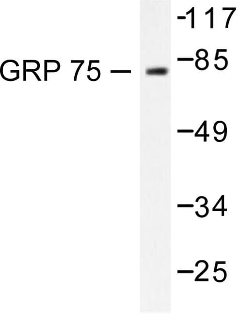 HSPA9 / Mortalin / GRP75 Antibody (Ser664)