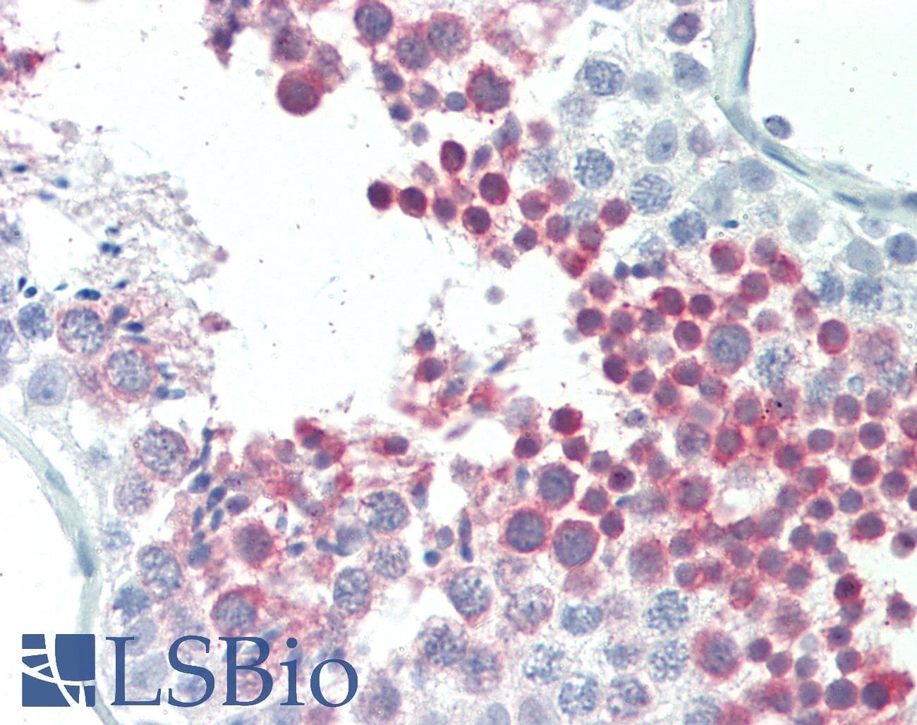 IHC-plus™ MEPCE Antibody (aa408-420)