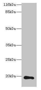 Polyclonal Rabbit anti-Human RAB30 Antibody (IHC, WB)