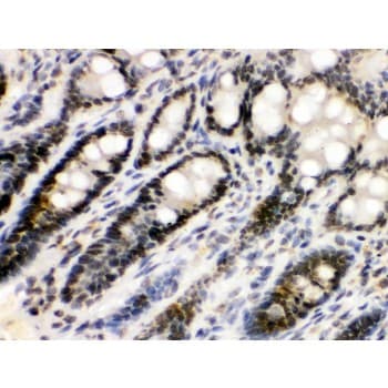Polyclonal Rabbit anti-Human EME1 Antibody (aa520-561, IHC, WB)