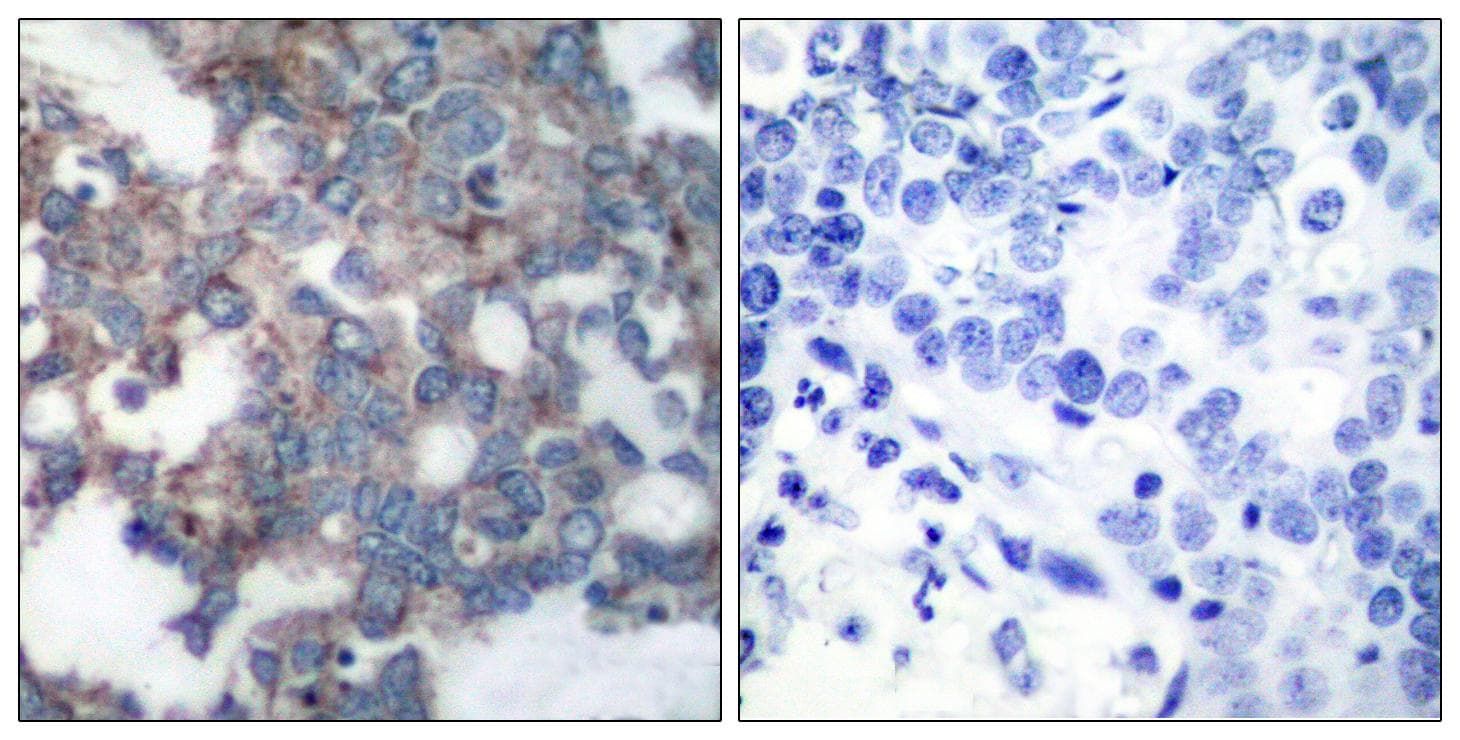 RPS6KB1 / P70S6K / S6K Antibody (phospho-Ser424)