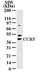 Polyclonal Rabbit anti-Human CCR5 Antibody (WB)