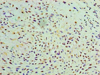GALE / UDP-Glucose 4-Epimerase Antibody (aa1-348)