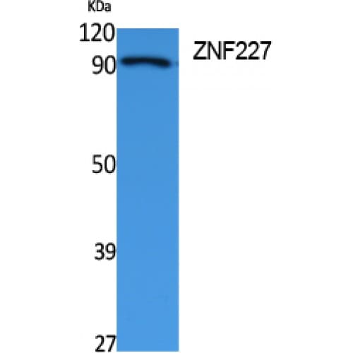 Polyclonal Rabbit anti-Human ZNF227 Antibody (Internal, WB)