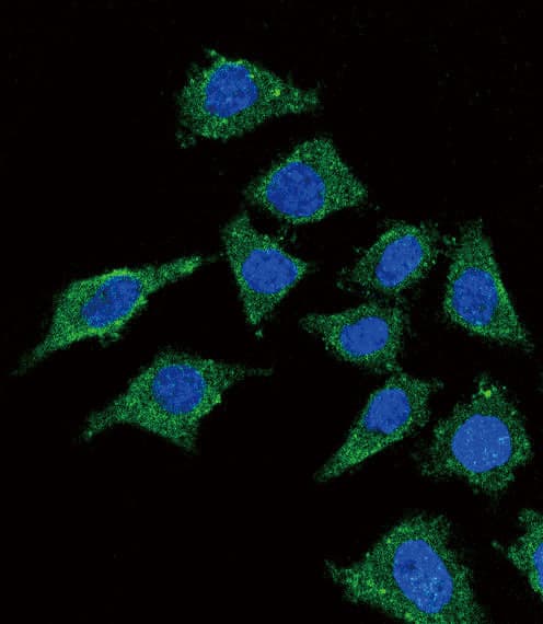 LCAT Antibody (aa285-313)