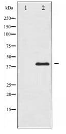 Polyclonal Rabbit anti-Human MAP2K3 / MEK3 / MKK3 Antibody (IHC, WB)