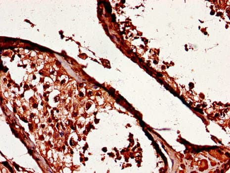 YES1 / c-Yes Antibody