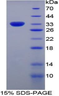 Human MX1 / MX Protein (Recombinant His)