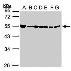 IHC-plus™ DDX39 Antibody (aa53-425)