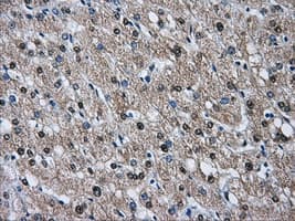Heat Shock Protein 70 / HSPA1A Antibody (clone OTI1H5)