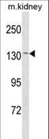 Polyclonal Rabbit anti-Human CASR/Calcium Sensing Receptor Antibody (aa260-287, WB)