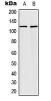 FGFR1 / FGF Receptor 1 Antibody (C-Terminus)